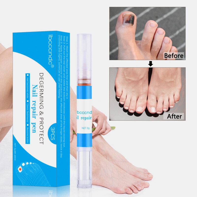 3ml Λάδι Επιδιόρθωσης Ονυχομυκητίασης Θεραπείας Μυκήτων Νυχιών Πέννα Για Ανάπτυξη Κατά Των Μυκητιακών Λοιμώξεων Υγρό Αφαίρεσης Επιδερμίδας